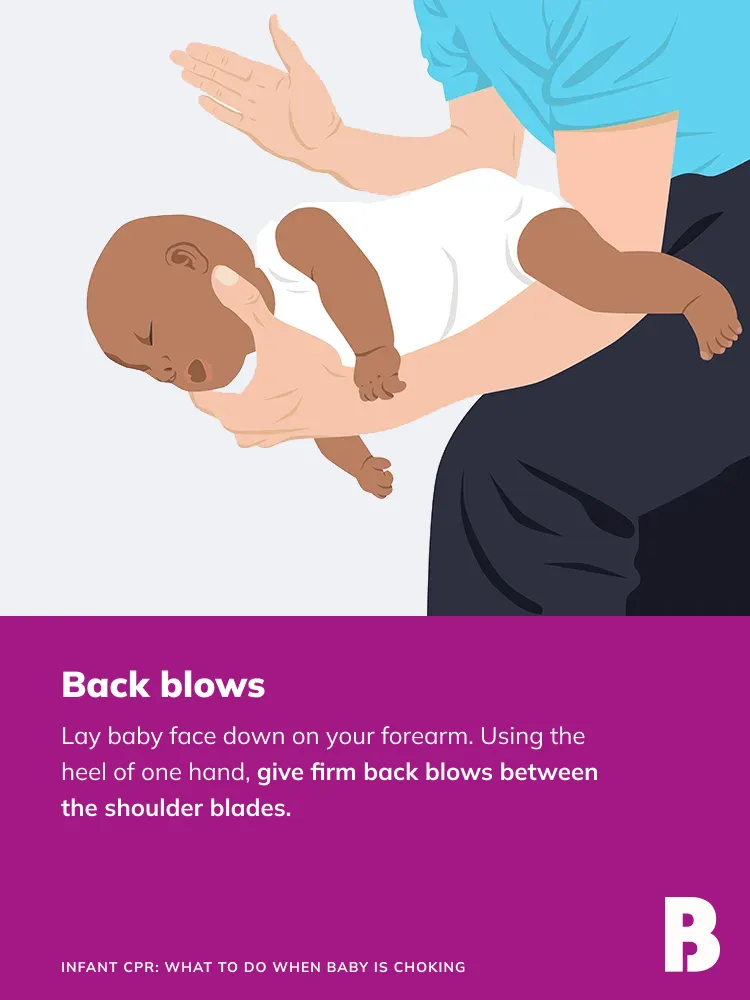 What To Do When Baby Choking: A Comprehensive Emergency Guide Effective back blows technique for infants, a crucial step when baby is choking
